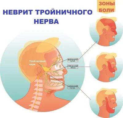 Тройничный нерв (V пара). Часть 1 (Анатомия) | ВКонтакте