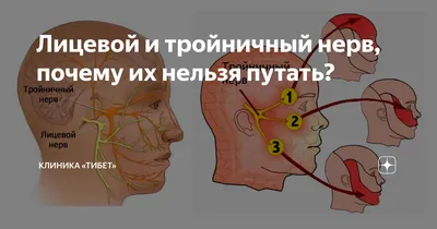 Невралгия тройничного нерва - симптомы и причины - Медицинский центр