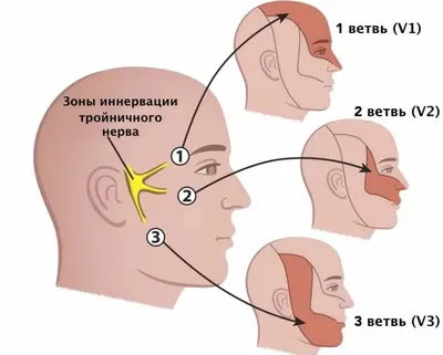 Невралгия тройничного нерва - Клиника доктора Максудовой