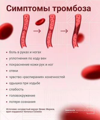 Тромбоз глубоких вен нижних конечностей: почему возникают тромбы и что с  этим делать? | О здоровье: с медицинского на русский | Дзен