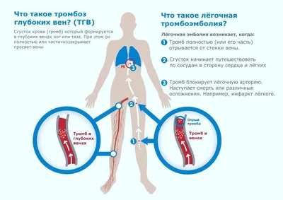 Пути распространения тромбозов и тромбофлебитов на лице - Различие в  строении вен лица и их значение в хирургии - Венозная система человека -  Цікава інформація медичної спрямованості - Анатомія людини