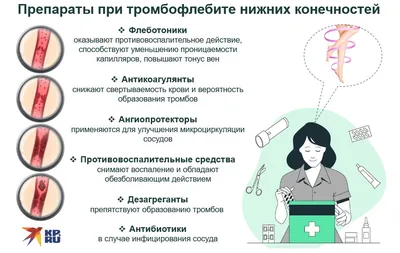 Диагностика острого тромбофлебита в Октябрьском