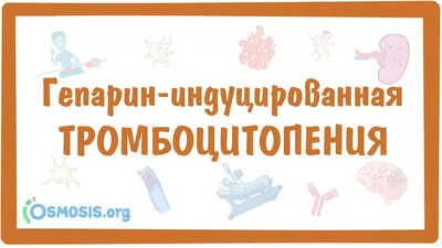 Тромбоцитопении – тема научной статьи по клинической медицине читайте  бесплатно текст научно-исследовательской работы в электронной библиотеке  КиберЛенинка