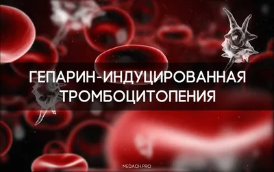 Лекарственно-индуцированная иммунная тромбоцитопения: обзор клинического  случая - parodont.pro