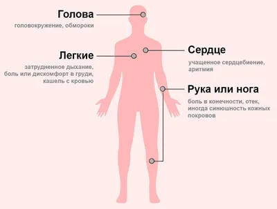 Тромбоз глубоких вен нижних конечностей: причины, симптомы, диагностика и  лечение болезней