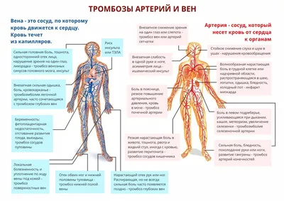 Венозный тромбоз?.. Готовь антикоагулянтов воз! | Статьи