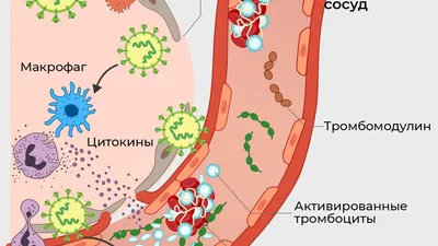 ПРИЗНАКИ и СИМПТОМЫ ТРОМБОЗА глубоких ВЕН. Тромбоз глубоких вен возникает,  когда сгусток крови — ⚠️ТРОМБ — образуется в одной или… | Instagram