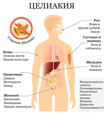 Морфология и клинические проявления целиакии