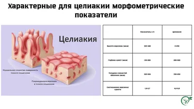 Клинико-лабораторный менеджмент диагностики целиакии