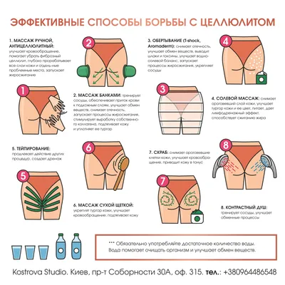 Целлюлит Оранжевая Корочка Ногах Снижение Избыточного Веса Борьба Целлюлитом  Подкожное стоковое фото ©melis82 558474814