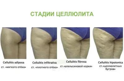 Simildiet Laboratorios Пищевая добавка \"Снижение веса, целлюлит\" Metabol -  купить, цена, отзывы - Icosmo