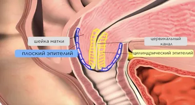 Шейка матки во время беременности: какие могут быть изменения? | За  Рождение | Дзен