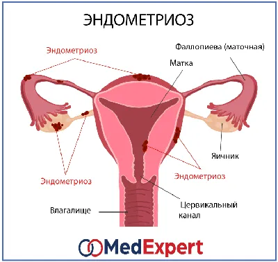 УЗИ шейки матки (цервикометрия), сделать в Ростове-на-Дону