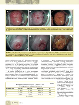 ХРОНИЧЕСКИЙ ЦЕРВИЦИТ И ПАПИЛЛОМАВИРУСНАЯ ИНФЕКЦИЯ