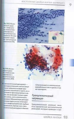 Заболевания шейки матки: диагностика и лечение патологии