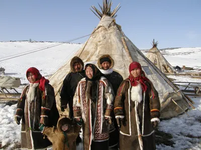 Цинга. Пеллагра. Куриная слепота, ксерофтальмия, общий ксероз реферат 2010  по медицине | Сочинения Медицина | Docsity