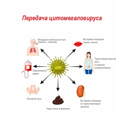Цитомегаловирус - причины появления, симптомы заболевания, диагностика и  способы лечения