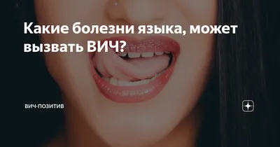 Проявления ВИЧ-инфекции в челюстно-лицевой области у детей – тема научной  статьи по клинической медицине читайте бесплатно текст  научно-исследовательской работы в электронной библиотеке КиберЛенинка