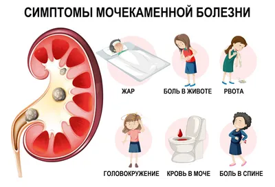 Желтуха, гепатит и цирроз печени - симптомы, диагностика и лечение