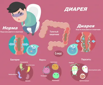 Цвет кала при гепатите фото