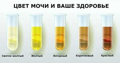 Цвет мочи График оценки гидратации и обезвоживания Иллюстрация вектора -  иллюстрации насчитывающей кровь, медицинско: 163618544