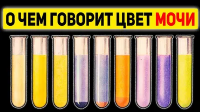 Как “прочесть” цвет мочи. / How to 'read' urine colour. | ВКонтакте