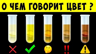 Кровь в моче у ребенка, почему такое бывает и что делать?