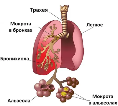 Виды мокроты: о чем говорит цвет слизи - ЗНАЙ ЮА