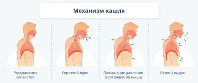 Кашель с мокротой - причины, как лечить у ребенка и взрослого