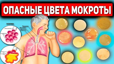 Врачи Не Говорят! Что На Самом Деле Значат Странные Цвета Мокроты - YouTube