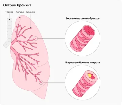 Симптомы коронавируса – первые признаки, профилактика, по дням, без  температуры