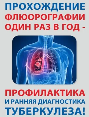 Туберкулез - Dr. Charis Armeftis - the Lung Centre