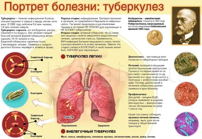 Может ли туберкулез пройти сам по себе - первичное и вторичное  инфицирование и профилактика заболевания