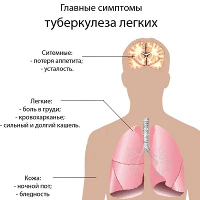 Это должен знать каждый: туберкулез