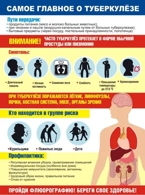 Туберкулез: симптомы и лечение / Новости общества Красноярска и  Красноярского края / Newslab.Ru