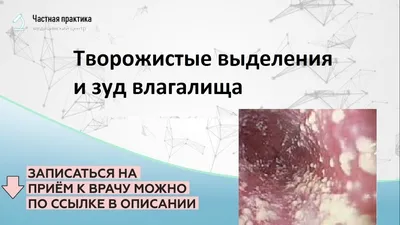 Лечение выделений с запахом у гинеколога в СПб - цены