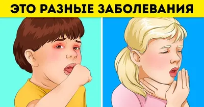 ᐈ Стоматит на языке у детей: фото ᐈ Как и чем лечить стоматит на языке  ребенка