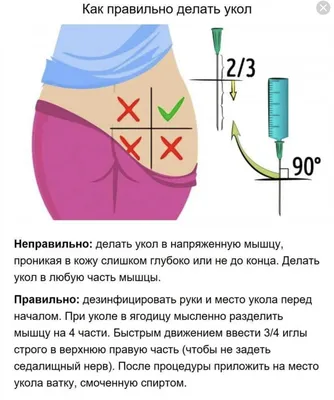 Зона укола в ягодицу рисунок - 72 фото