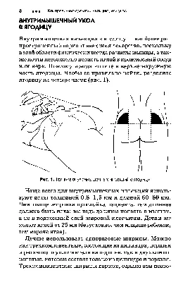 Секреты и техника. Как правильно делать уколы и избежать ошибок | ОБЩЕСТВО  | АиФ Барнаул