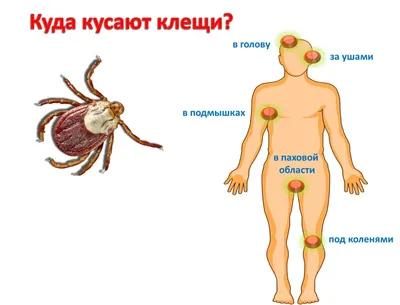 Жителя Сковородинского округа укусил энцефалитный клещ — Амурская правда,  новости Благовещенска и Амурской области