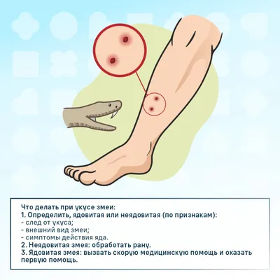 Укус змеи: первая помощь, последствия, советы специалистов