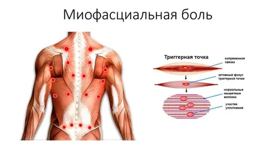 Флегмоны шеи - симптомы и лечение | Статьи EMC