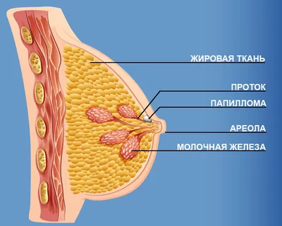 Мастопатия