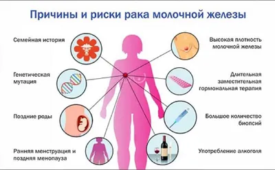 Специалист рассказала о факторах риска развития рака молочной железы и как  обезопасить себя | 15.10.2023 | Чистополь - БезФормата