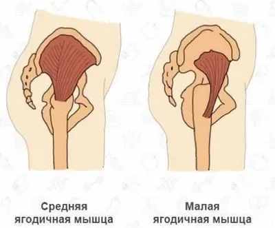 Упражнения на бедра - Упражнения с эспандерами - Упражнения с эспандером и  утяжелителями - Каталог статей - Упражнения с утяжелителями и эспандерами