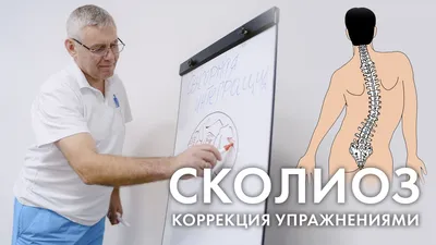 Комплекс упражнений при сколиозе, как скорректировать осанку - Чемпионат