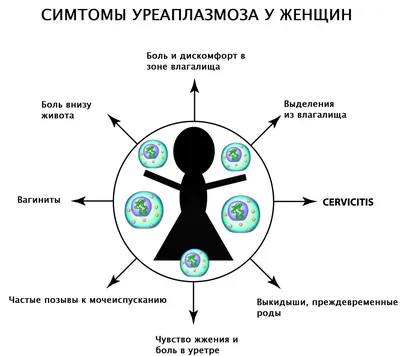 Уреаплазмоз. Уреаплазма (уреалитикум, парвум, специес) - причины появления,  симптомы заболевания, диагностика и способы лечения