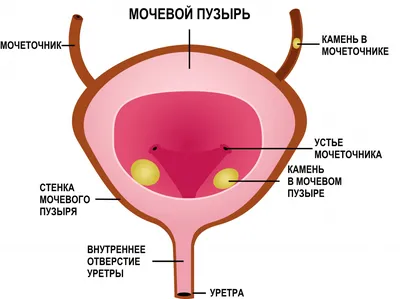 Лечение климакса: менопаузальная терапия - Клиника Ваш Врач - медицинский  центр в Ярославле