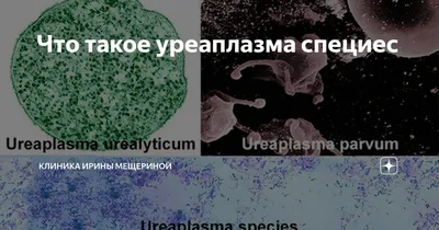 Уреаплазмоз: симптомы, методы диагностики и лечения. Уреаплазма – инфекция  мочеполовых путей. Лечение уреаплазмоза у бременных