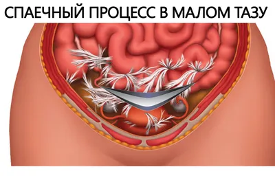 Анализы на уреаплазму у женщин и мужчин: нормы, расшифровка результатов,  как подготовиться и где сдать анализ на уреаплазму?